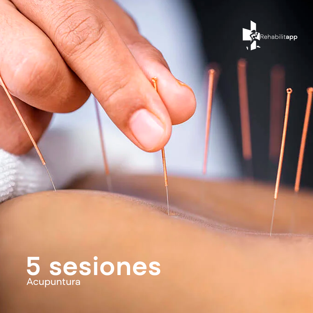 5 SESIONES DE ACUPUNTURA